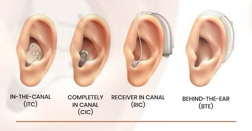 Types of hearing aids diagram