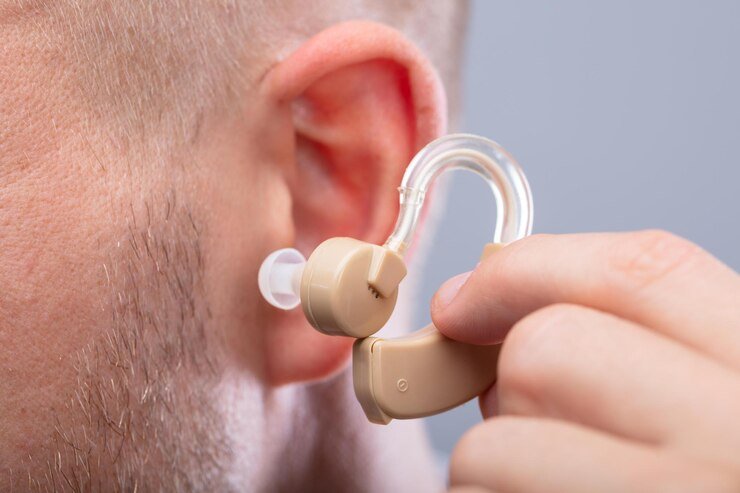 Best Hearing Aid Dealers in Defence Colony