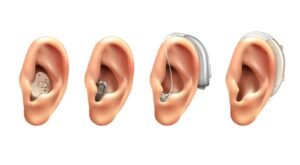best in the canal hearing aid in South Delhi