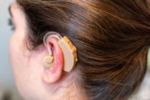 Best Phonak L30 hearing aid in South Delhi